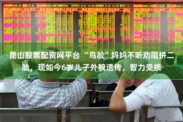 昆山股票配资网平台 “鸟脸”妈妈不听劝阻拼二胎，现如今6岁儿子外貌遗传，智力受损